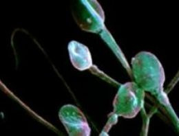 Beslenme sperm sayısını nasıl etkiliyor? Beslenme sperm sayısını nasıl etkiliyor?